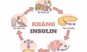 Omega-7 có giúp cải thiện đề kháng insulin và sức khỏe chuyển hóa?