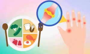 Người bị axit uric cao nên ăn gì để tốt cho sức khỏe