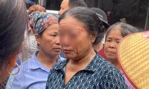 Nguyên nhân vụ người phụ nữ bị xịt nước, chảy máu mắt ở Phú Thọ