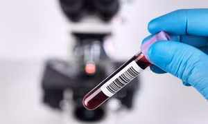 Sau tiêm 2 mũi vaccine COVID-19, có cần làm xét nghiệm kháng thể?
