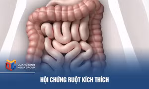 Hội chứng ruột kích thích