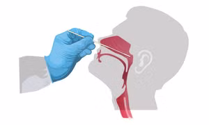 Nhiễm COVID-19, sao có người bị nặng, người nhẹ?