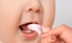 Cách chăm sóc đúng khi trẻ bị nhiệt miệng