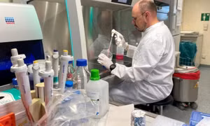 CDC Mỹ: Virus đậu mùa khỉ có thể bám trên các vật dụng trong nhà