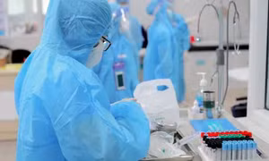 Sáng 27/8: Việt Nam đã ghi nhận ca COVID-19 nhiễm biến thể phụ BA.4, BA.5, BA.2.74