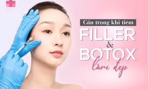 Tiêm filler và botox làm đẹp đón Tết, cách nào tốt hơn?