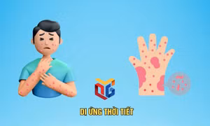 Cách xử trí khi bị dị ứng thời tiết