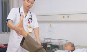 Lời khuyên của bác sĩ để phòng, điều trị đột quỵ não ngày nắng nóng