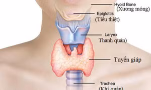 Những bệnh khiến bạn khó giảm cân