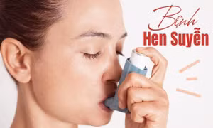 Người bệnh hen có phải kiêng đồ ăn tanh?