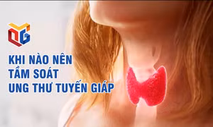 Khi nào nên tầm soát ung thư tuyến giáp
