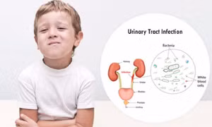 Nhiễm trùng tiểu ở trẻ: Nguyên nhân và những điều cha mẹ cần biết