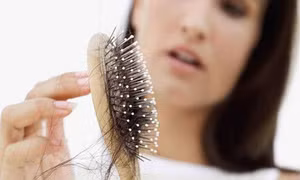 F0 khỏi bệnh rụng tóc đến hói đầu, bác sĩ chỉ cách khắc phục