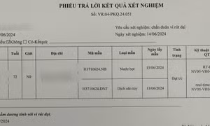 Hai tháng sau khi bị chó cắn, cụ bà nguy cơ tử vong vì bệnh dại