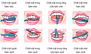 Chăm sóc răng miệng đúng cách mùa COVID