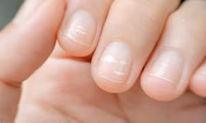  Không phải xem chỉ tay, nhìn móng tay của mình thuộc loại nào trong 7 kiểu dưới đây sẽ giúp bạn đoán được sức khỏe của bản thân