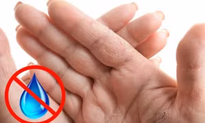 7 dấu hiệu trên bàn tay cảnh báo bất ổn về sức khỏe