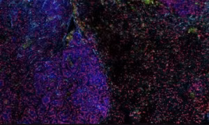 Phát hiện virus cổ đại có thể giúp điều trị ung thư phổi