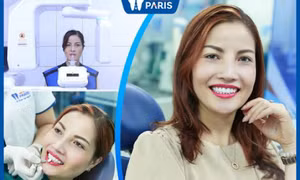 Bọc răng sứ Nha khoa Paris bao nhiêu tiền 