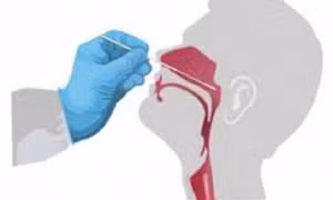 Lưu ý quan trọng khi tự làm test nhanh COVID-19 tại nhà