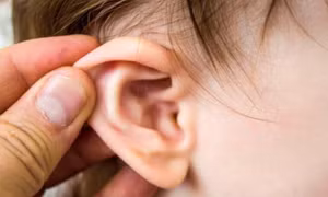 Phòng ngừa và nhận biết những biến chứng nguy hiểm do viêm tai giữa tiết dịch ở trẻ