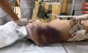 'Dì ghẻ' bị khởi tố tội danh kịch khung 3 năm tù, nhiều luật sư không đồng tình