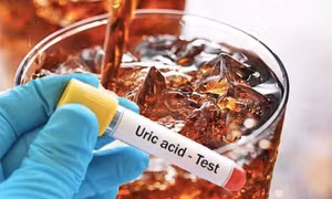 Tác động của việc uống nhiều nước ngọt đến người có axit uric cao