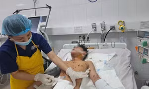 Nhiều trẻ em nhập viện do tự chế pháo dịp cận Tết