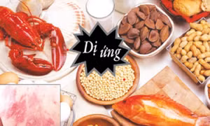 Người bị dị ứng thực phẩm có thêm thuốc điều trị mới
