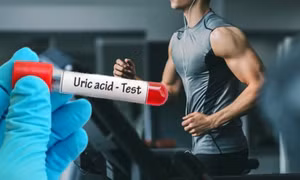 5 thói quen nam giới nên duy trì để giảm axit uric