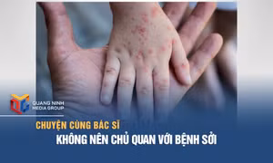 Không nên chủ quan với bệnh sởi