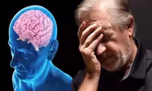 Phát hiện mới mang lại triển vọng phát triển phương pháp trị bệnh Alzheimer
