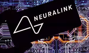 Chip đọc não của Elon Musk bị 'lỏng dây'