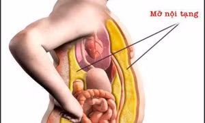 Mỡ nội tạng có hại thế nào với sức khỏe?
