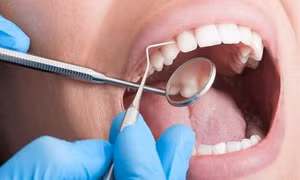 3 cách chống mòn răng hiệu quả tối ưu cho trẻ nhỏ