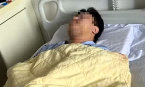 Bị cho là 'nhìn đểu', nam sinh viên phải nhập viện trong tình trạng gãy xương hàm