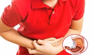 Căng thẳng, stress có gây viêm loét dạ dày không?