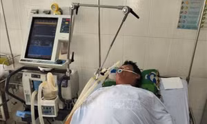 Cà Mau: 4 người nhập viện cấp cứu vì ăn cá nóc 