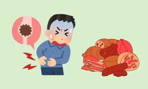 Tiêu thụ protein quá mức và nguy cơ hình thành sỏi thận