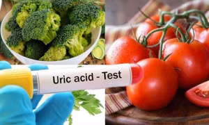 Thực phẩm giúp giảm axit uric trong cuộc sống hằng ngày