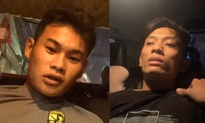 Hai thanh niên đánh người phụ nữ chấn thương sọ não để cướp điện thoại