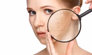  7 cách hạn chế bong tróc da khi thời tiết hanh khô