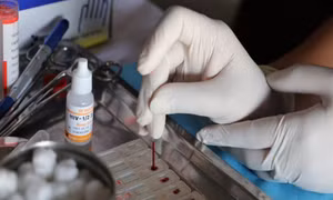 Ngày Thế giới phòng, chống AIDS (1/12): "Chấm dứt dịch AIDS - Thanh niên sẵn sàng"