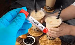Tác động của trà sữa với người có chỉ số axit uric cao