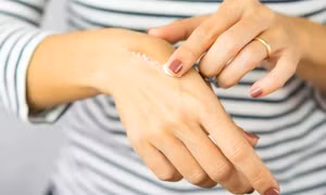 Cách chăm sóc vết thương để không bị sẹo
