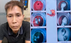 Gặp công an, nuốt luôn ma túy phi tang