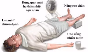 Xử trí khi bị say nắng ngày hè 