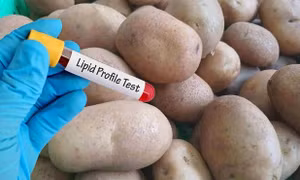 3 loại thực phẩm chay có thể gây tăng lipid máu