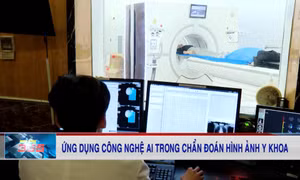 Ứng dụng công nghệ AI tạo ra đột phá trong chẩn đoán hình ảnh y khoa