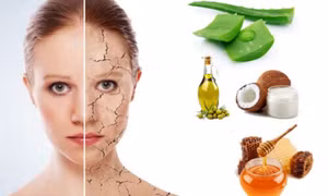 Ứng phó với da khô tại nhà như thế nào?